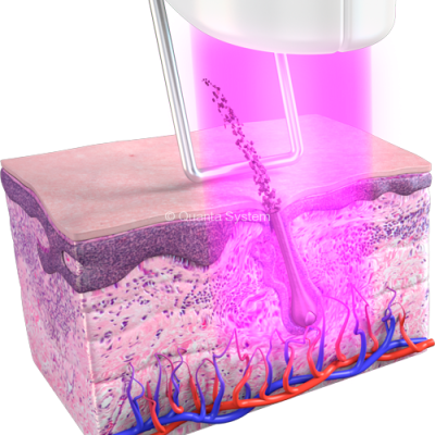 Duetto_Epilazione_MT