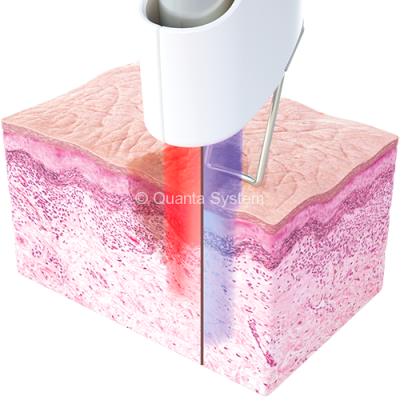 Duetto_SkinRejuv_1064-1