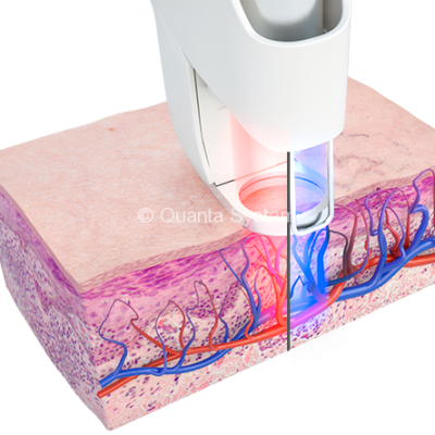 Duetto_Vascolare_755-1