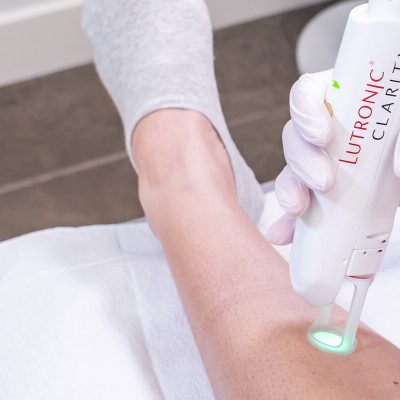clarity-laser-hair-removal-surrey-lower-leg-1640x800-1